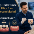 Eksik Diş Tedavisinde İmplant, Köprü ve Protez Seçeneklerini Nasıl Değerlendirmeliyiz?